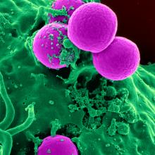 mrsa